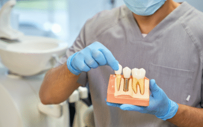 Dental Implants: Front Teeth Special Considerations