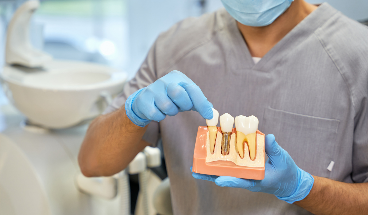 Dental implants at Pavilion Dentistry showing natural-looking front tooth restoration with perfect gum contours