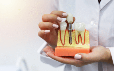 Dental Implants: Are You a Good Candidate?
