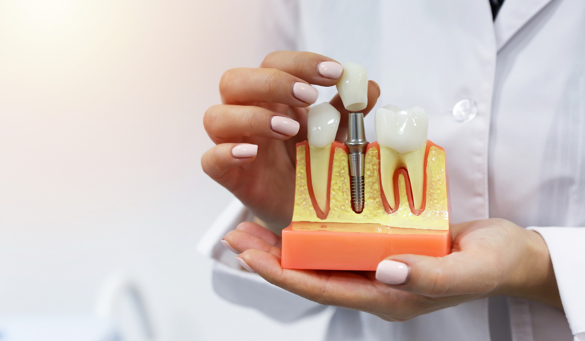 Dental implants candidacy evaluation at Pavilion Dentistry showing comprehensive assessment process for potential implant patients