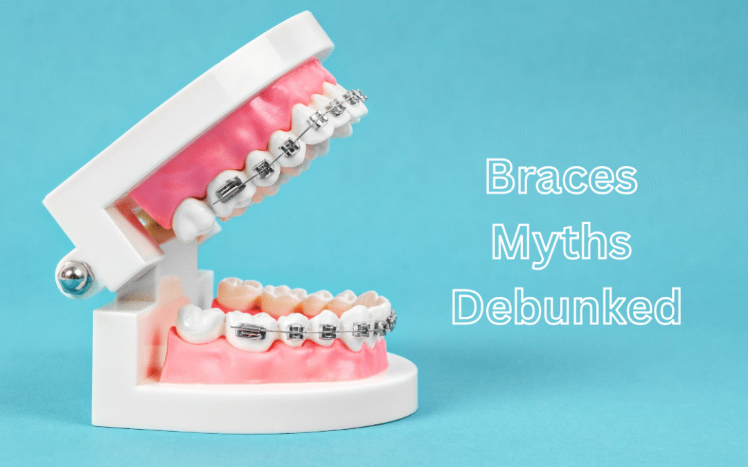 Braces Myths Debunked: Separating Fact from Fiction