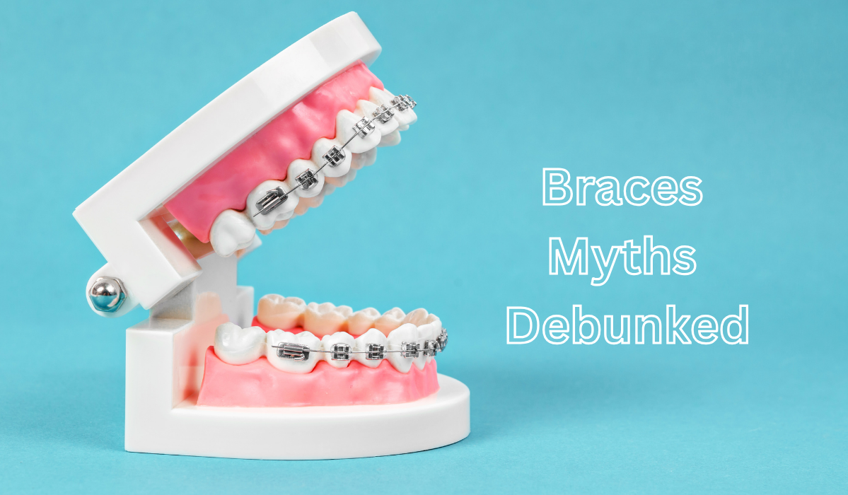 Braces at Pavilion Dentistry showing modern orthodontic options that debunk common myths about traditional metal braces treatment