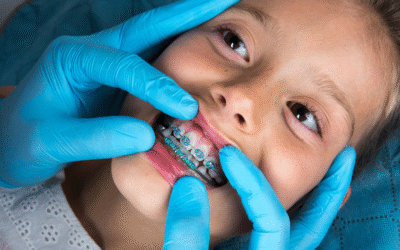 Orthodontist: When Should You See One? Timing Guide