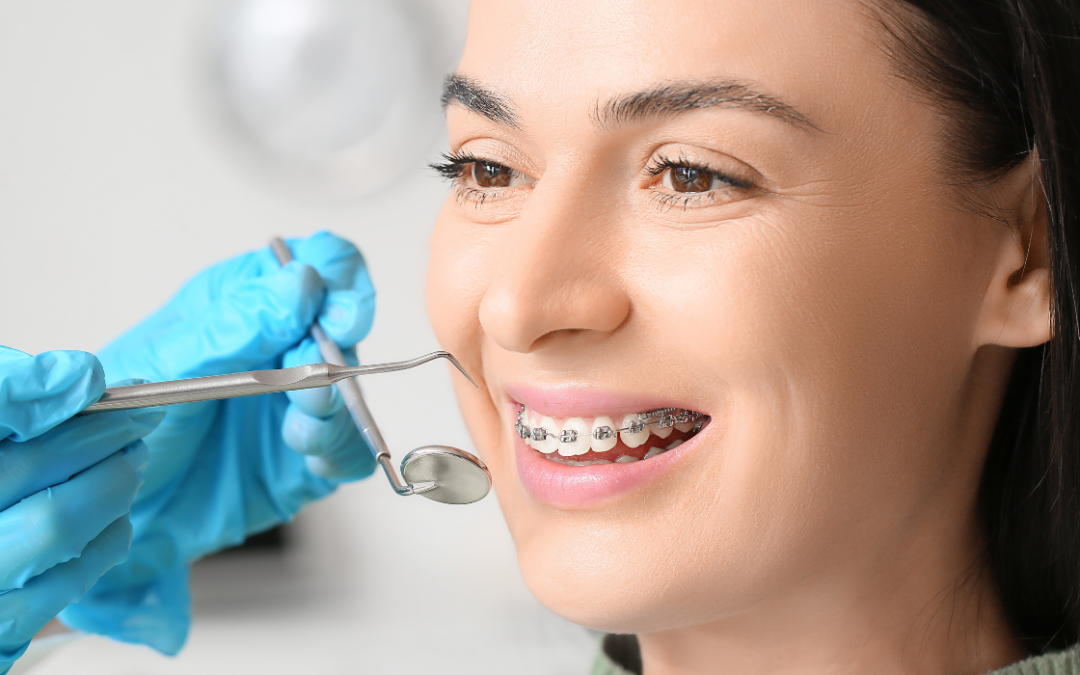 Braces Emergencies: What to Do When Problems Arise