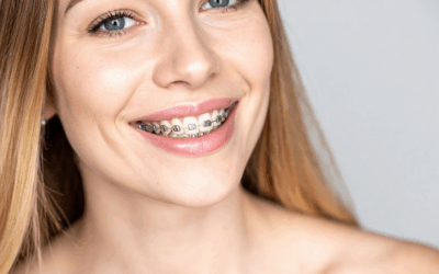 Braces and Oral Health: Preventing Treatment Complications