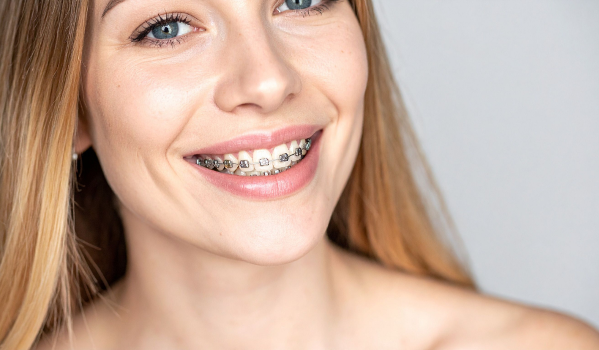 Braces oral health care at Pavilion Dentistry showing proper cleaning techniques and preventive strategies for maintaining healthy teeth during orthodontic treatment